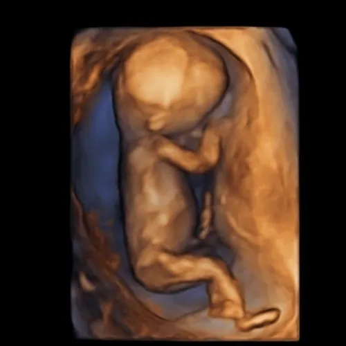 Real keepsake ultrasound image from Preggoland Mamas