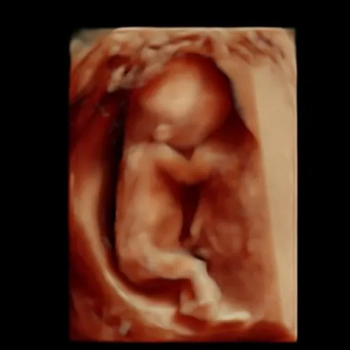 Real keepsake ultrasound image from Preggoland Mamas