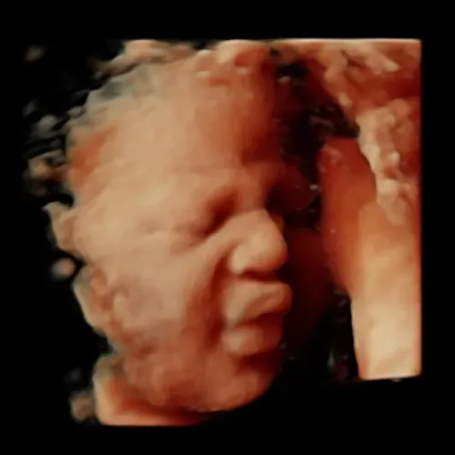 Real keepsake ultrasound image from Preggoland Mamas