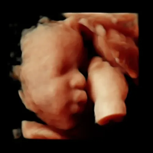 Real keepsake ultrasound image from Preggoland Mamas