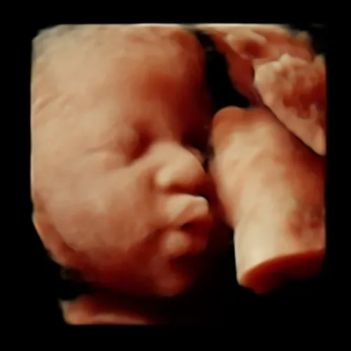 Real keepsake ultrasound image from Preggoland Mamas