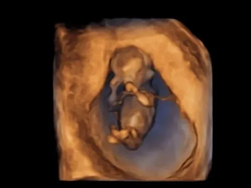 5D/HD Live gender reveal experience (14+ weeks required)