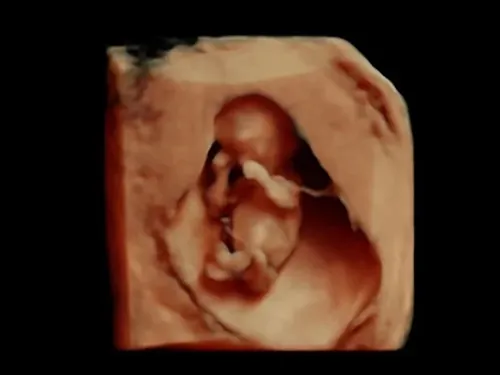 Real keepsake ultrasound image from Preggoland Mamas