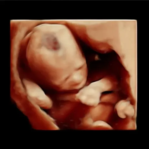 Real keepsake ultrasound image from Preggoland Mamas