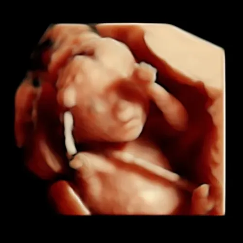 Real keepsake ultrasound image from Preggoland Mamas