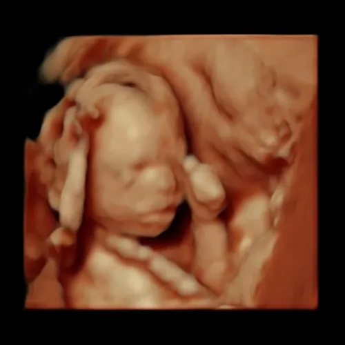 Real keepsake ultrasound image from Preggoland Mamas