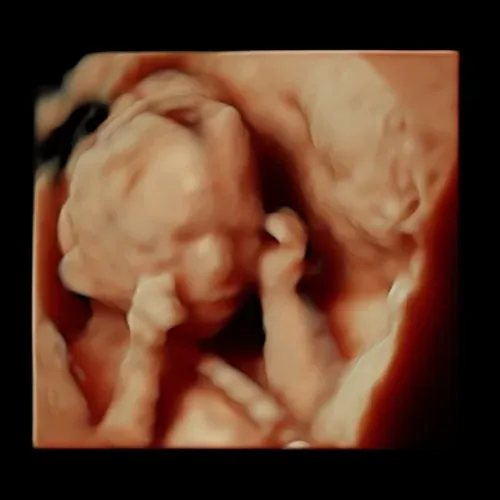 5D/HD Live basic digital ultrasound experience (available 12+ weeks)
