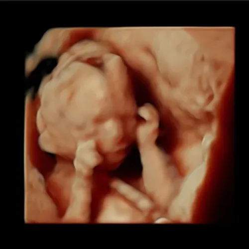 Real keepsake ultrasound image from Preggoland Mamas