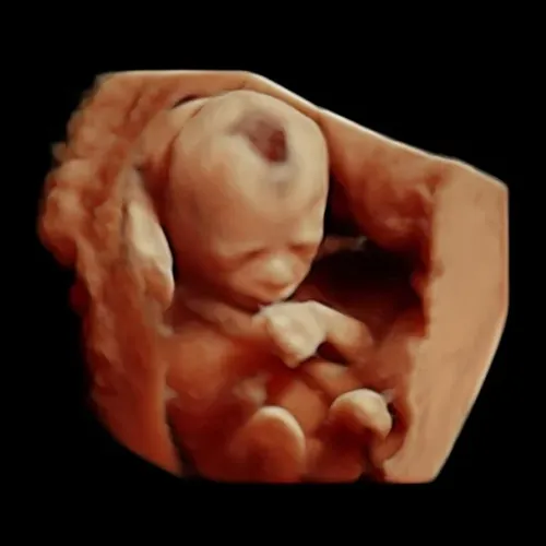 Real keepsake ultrasound image from Preggoland Mamas