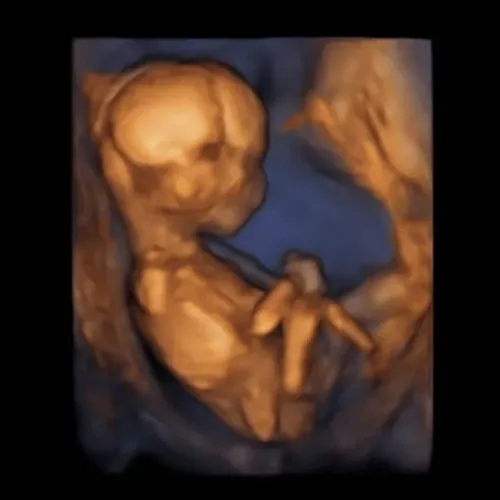 Real keepsake ultrasound image from Preggoland Mamas