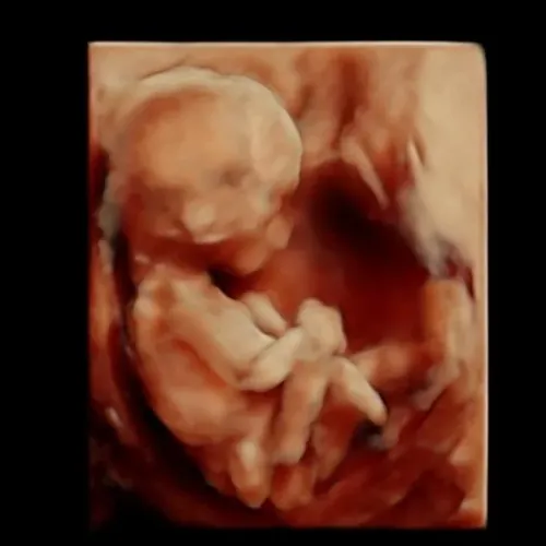 Real keepsake ultrasound image from Preggoland Mamas