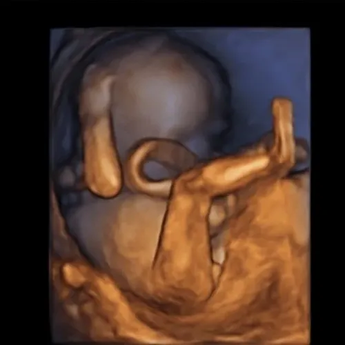 Real keepsake ultrasound image from Preggoland Mamas
