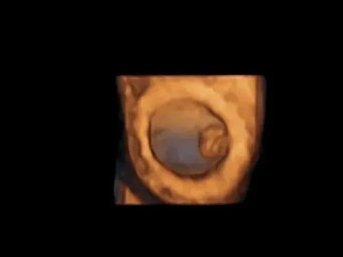Real keepsake ultrasound image from Preggoland Mamas