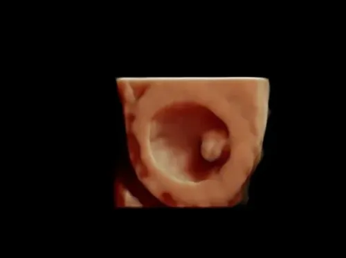 Real keepsake ultrasound image from Preggoland Mamas