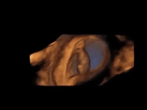 Real keepsake ultrasound image from Preggoland Mamas