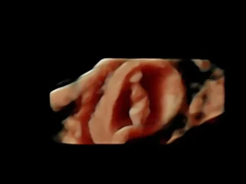 Real keepsake ultrasound image from Preggoland Mamas