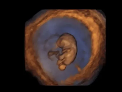 Real keepsake ultrasound image from Preggoland Mamas
