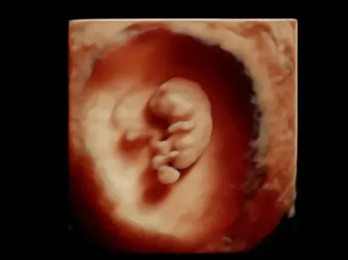 Real keepsake ultrasound image from Preggoland Mamas