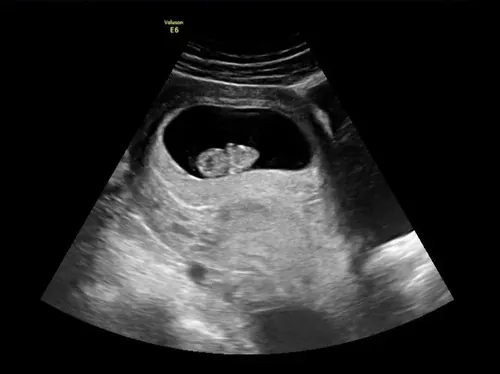 2D gender reveal experience (14+ weeks required)