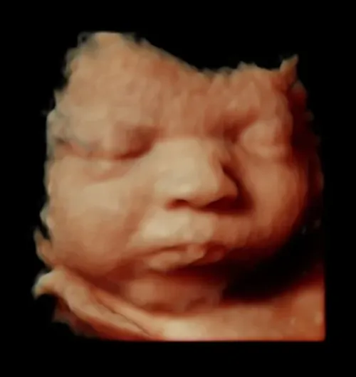 5D/HD Live Golden ultrasound experience (available for 12+ weeks)