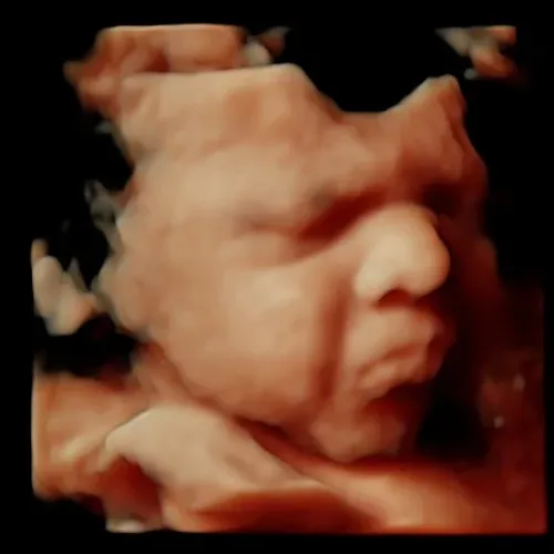 5D/HD Live Elite ultrasound experience (available for 12+ weeks)