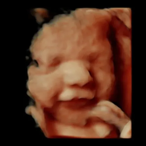 5D/HD Live Premium ultrasound experience (available for 12+ weeks)