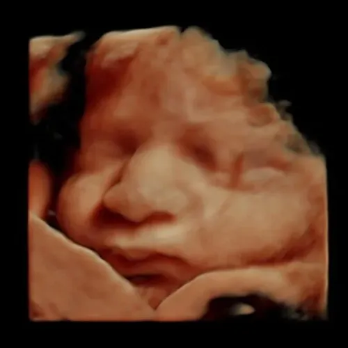 Real keepsake ultrasound image from Preggoland Mamas