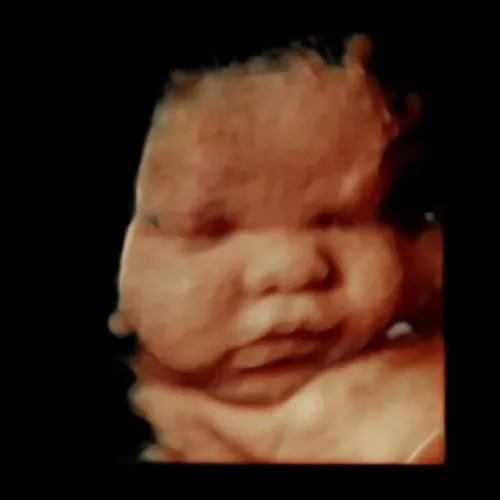 Real keepsake ultrasound image from Preggoland Mamas