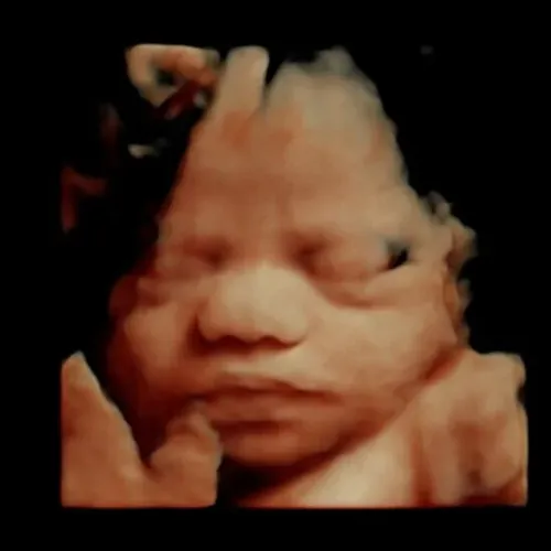 Real keepsake ultrasound image from Preggoland Mamas