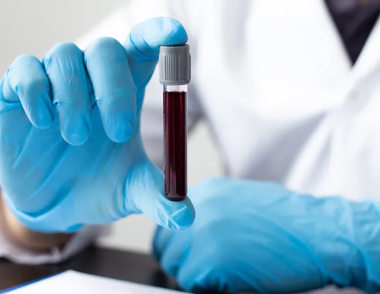 Lab tests