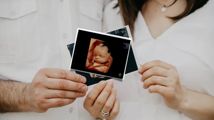 Ultrasound